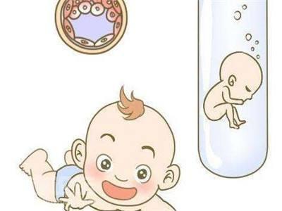 时差培养箱