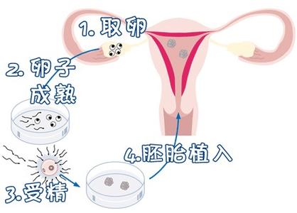专业供卵代怀服务